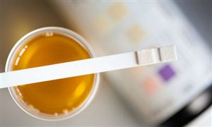 尿液诊断市场规模 2020尿液诊断行业发展现状及趋势分析​