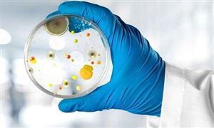 微生物检测市场值得投资吗？微生物检测市场发展分析及投资预测