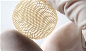 中国植入材料行业现状及发展前景分析