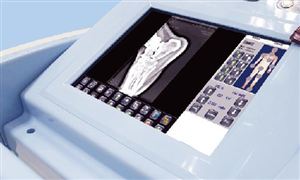 移动数字X射线系统行业市场发展现状 移动数字X射线系统行业市场发展前景分析