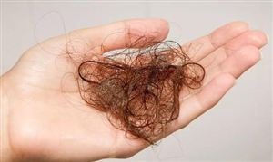 营养不良是脱发的重要原因 防脱生发行业调研与防脱生发行业前景分析