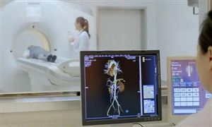 2022年造影剂行业发展前景及市场规模分析