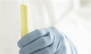 航空复合材料市场调研 2022航空复合材料行业前景及现状分析报告