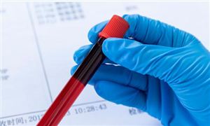 血液制品行业市场调研 血液制品行业投资分析