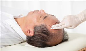 2022年防脱生发行业市场前景及规模调研分析