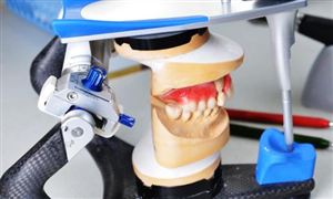 2022义齿行业调研 义齿行业前景及现状分析