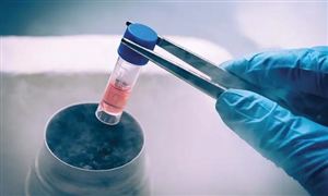 干细胞医疗行业市场调研 干细胞医疗市场规模预测