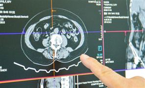 医学影像设备行业发展现状 便携化设备市场需求快速增加