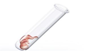 2022中国辅助生殖行业分析及发展