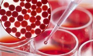 虾青素行业的市场规模点烟及虾青素市场前景投资分析 ​