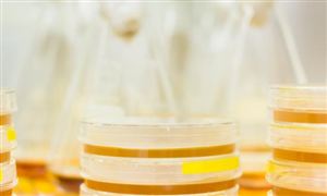 2023脱水培养基行业市场调研及发展趋势分析报告