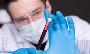 血液透析行业发展趋势分析 血液透析行业发展现状