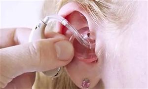 助听器使用率不到5% 助听器行业发展现状分析