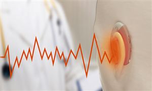 2022助听器行业分析报告 助听器成为老龄群体刚需