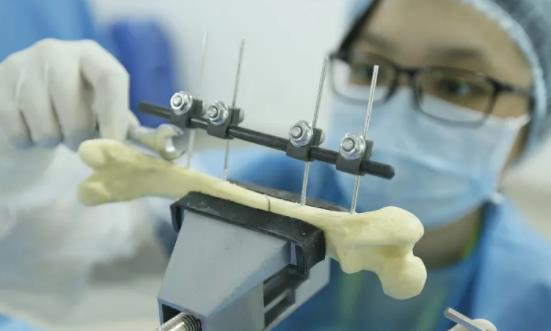 植入式医疗器械行业产业链分析