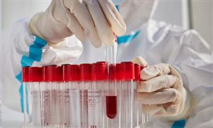 如何结束新冠?112国专家达成共识 中央部署进一步优化防疫20条措施