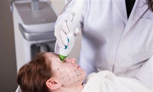 激光美容仪器市场规模占比及行业发展前景分析