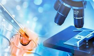 “试管婴儿”费用可报销 杭州明年起实施 辅助生殖行业市场运行态势分析