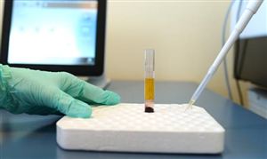 免疫诊断行业发展分析及免疫诊断行业发展趋势预测