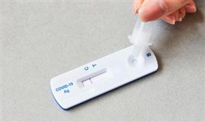 抗原试剂一盒难求局面或将扭转 抗原试剂行业现状及前景分析