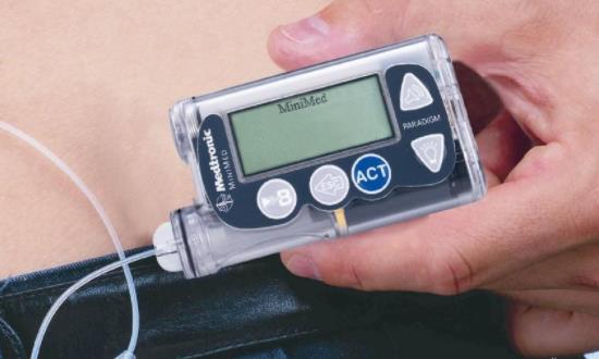 胰岛素泵市场深度分析 2023胰岛素泵行业市场规模及发展趋势预测