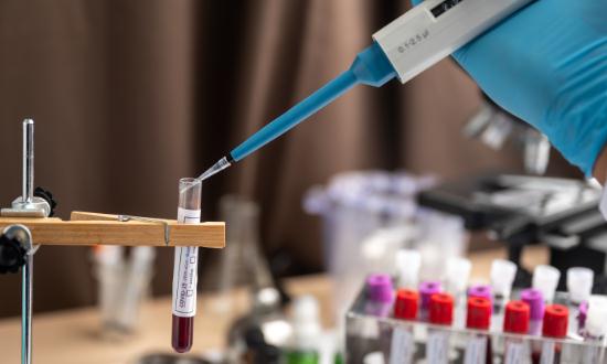 全球临床质谱检测市场规模分析及行业竞争格局分析2023