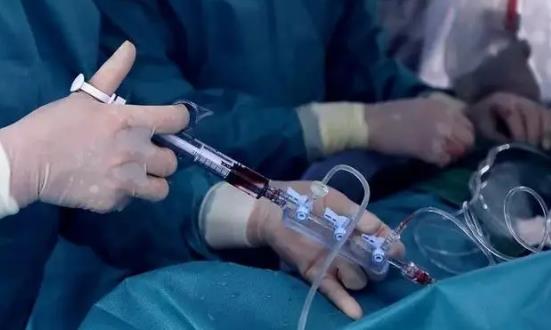 造影剂行业市场竞争现状 中国造影剂行业投资趋势预测