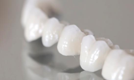 2023全瓷牙行业市场投资价值分析 未来潜在市场空间可达200亿元