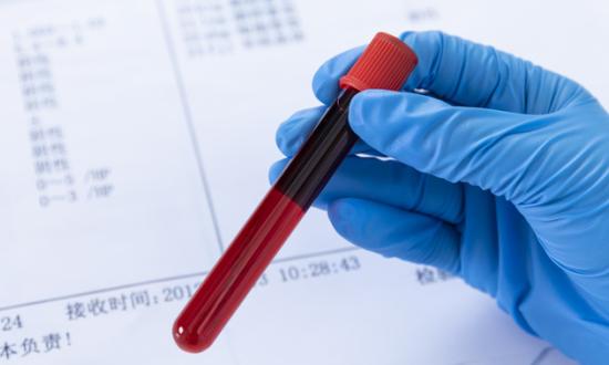 第三方医学诊断行业报告分析 2023第三方医学诊断市场发展机会