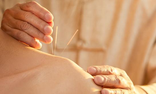 2023年针灸按摩行业市场投资价值评估 未来全球针灸针发展前景良好