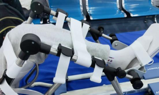 康复治疗行业发展机遇 康复治疗行业发展前景投资分析