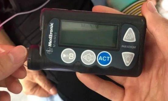 中国胰岛素泵市场发展空间 中国胰岛素泵市场规模预测