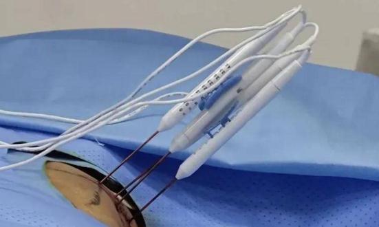 纳米刀行业发展现状及市场竞争格局分析2023