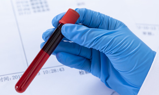 血液灌流器行业市场形势分析报告2023