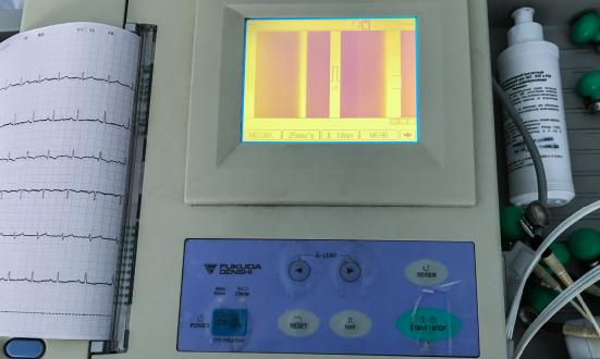 2023心电监护仪行业报告 心电监护仪行业市场现状调研及发展前景研究