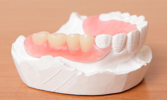 2023义齿行业发展现状及前景分析