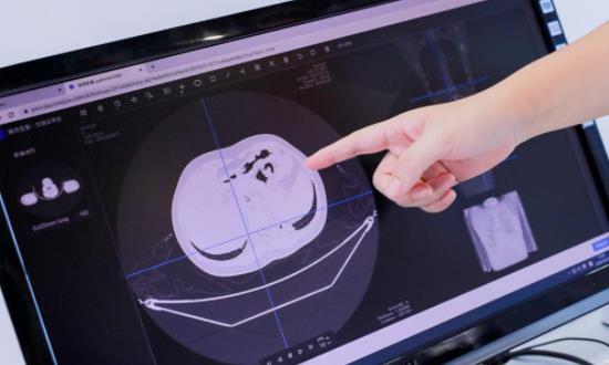 医疗影像云行业投资现状及前景分析2023