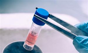 2023中国干细胞医疗市场现状及发展前景展望