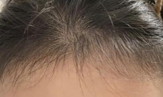 生发育发产品市场需求 生发育发行业发展前景投资分析2023