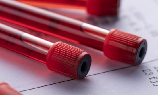 2023药用包装材料行业供需趋势及投资