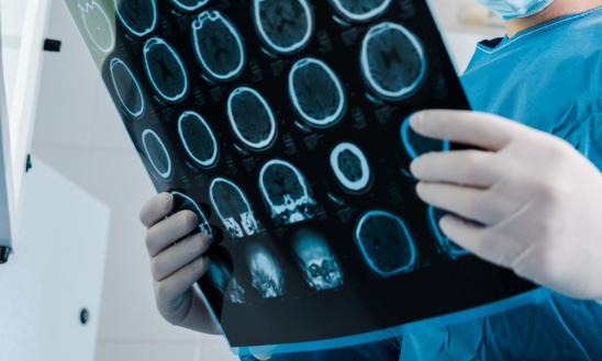 2023年中国医用X光机行业市场调研分析