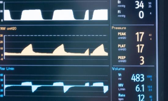 国内无创呼吸机(CPAP)行业市场容量 国内无创呼吸机(CPAP)行业发展趋势分析