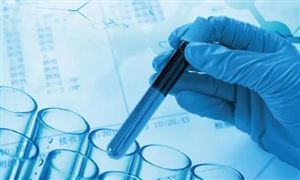 生物制药行业产业链 生物制药行业发展现状及市场调研