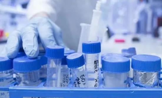 生物试剂行业市场占有率 2023生物分子试剂行业发展前景投资分析