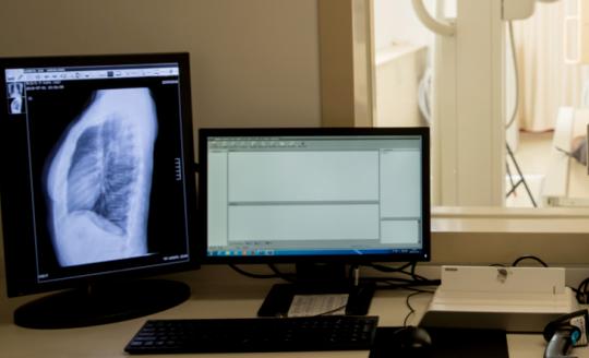 中国医用磁共振设备行业市场发展现状