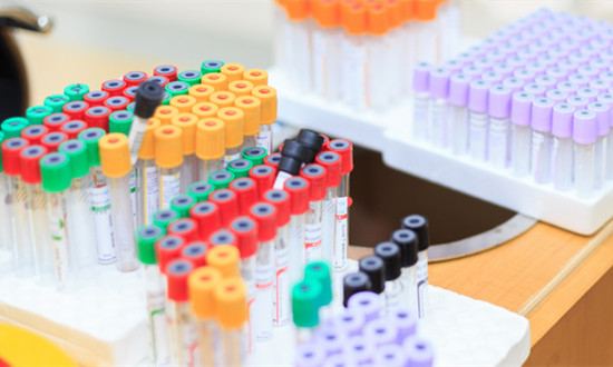 2023国内生化试剂行业市场规模及前景