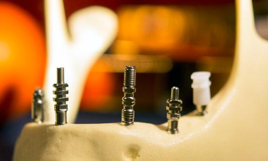 高纯钛市场深度全景调研及投资前景分析2023