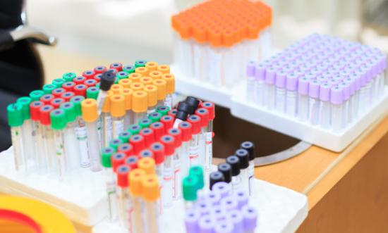 2023中国生化试剂市场深度全景调研分析