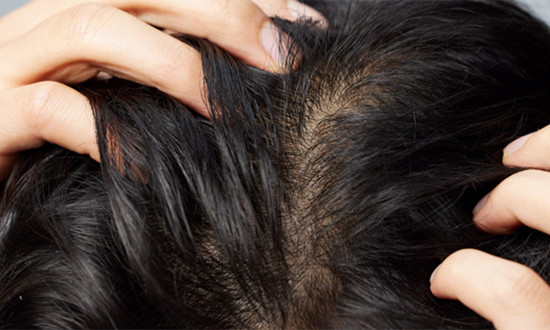 生发药物行业发展分析 生发药物行业市场投资潜力