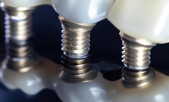 口腔正畸行业市场消费潜力 口腔正畸行业市场发展空间分析